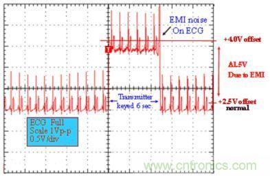图 1：医用 ECG 测量设备的性能