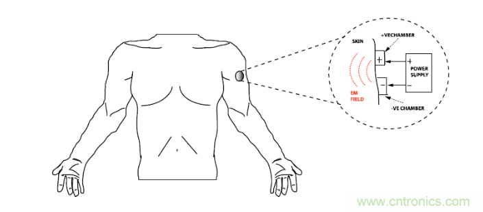 皮肤阻抗分析优化主动和被动给药