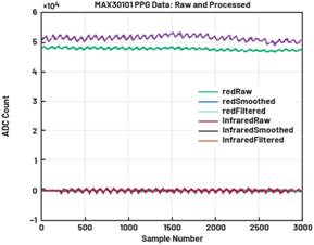 动态离散周期变换技术突破：无ECG参考的生理信号精准解析